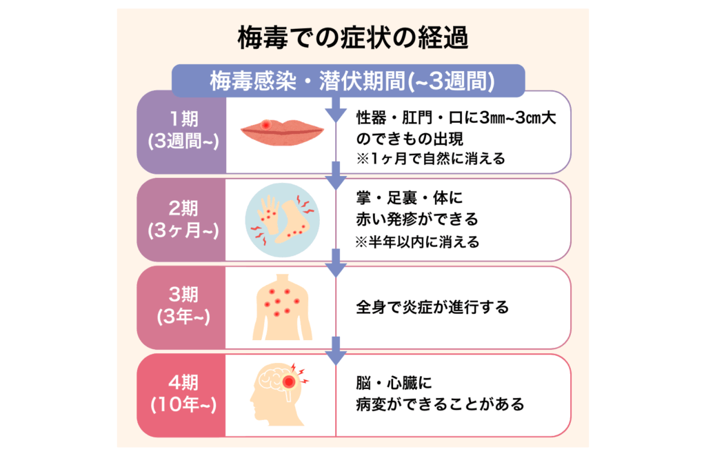 梅毒について