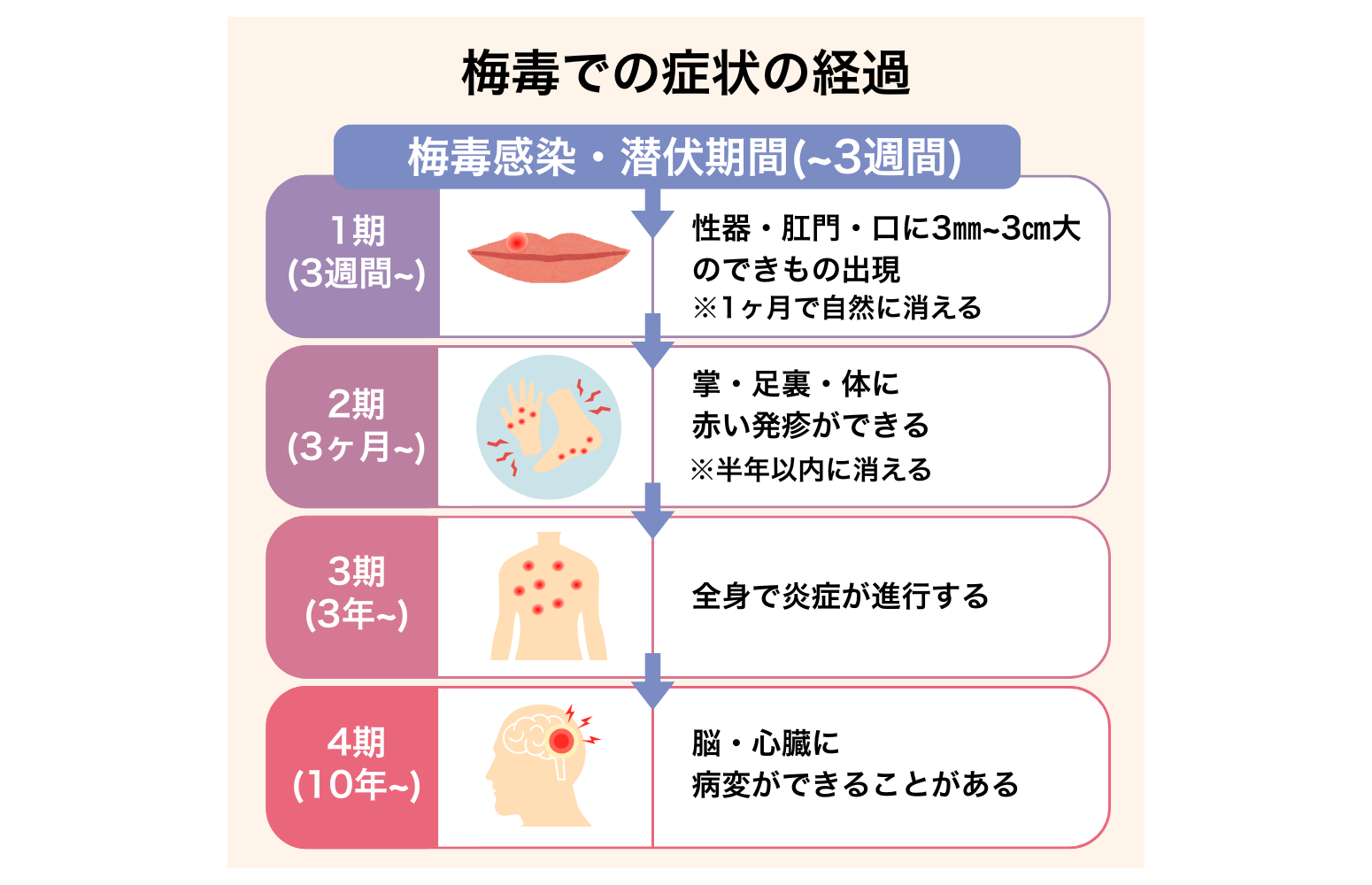梅毒について